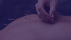 Replay on Demand: All About D.N.A: Seamless Integration of Dry Needling and Acupuncture