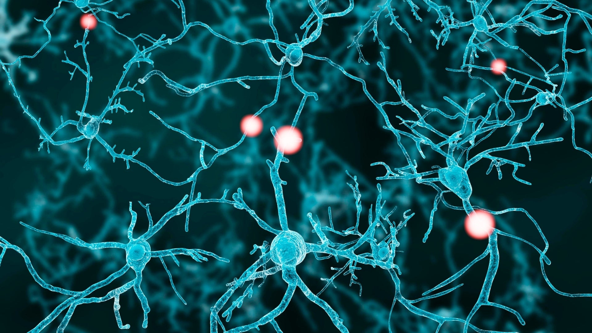 Neural Mobilization: A new Systematic Review Analyzes Therapeutic Efficacy